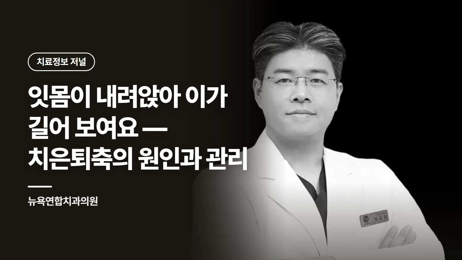 잇몸이 내려앉아 이가 길어 보여요 — 치은퇴축의 원인과 관리